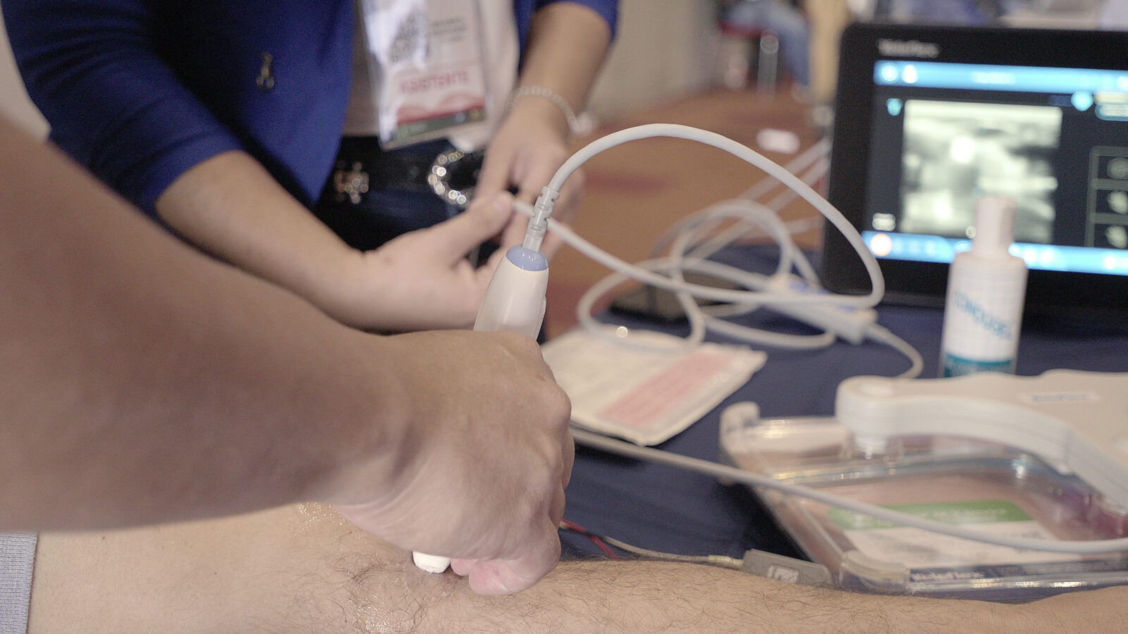 Primer plano de un transductor de ecografía apoyado sobre un antebrazo.